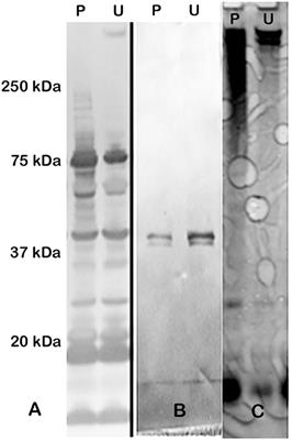 Further Characterization of the Capsule-Like Complex (CLC) Produced by Francisella tularensis Subspecies tularensis: Protective Efficacy and Similarity to Outer Membrane Vesicles